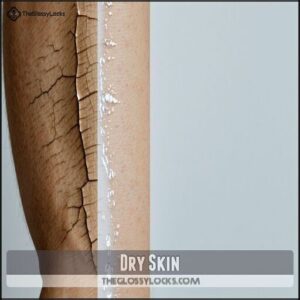 Dry Skin