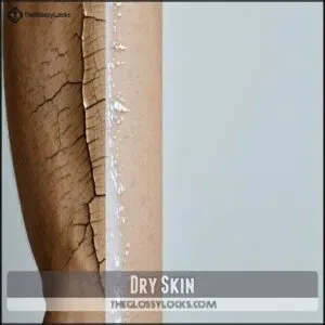 Dry Skin