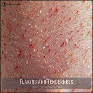 Flaking and Tenderness