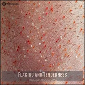 Flaking and Tenderness Flaking and Tenderness