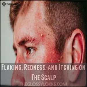 Flaking, Redness, and Itching on The Scalp