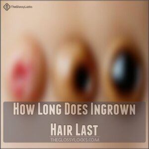 How Long Does Ingrown Hair Last How Long Does Ingrown Hair Last