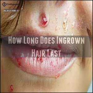 How Long Does Ingrown Hair Last
