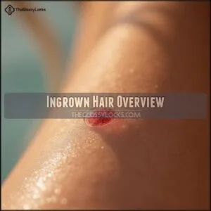 Ingrown Hair Overview