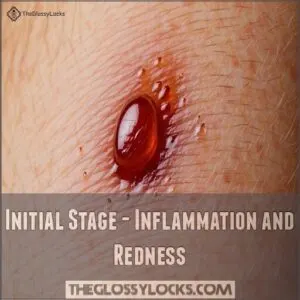 Initial Stage - Inflammation and Redness