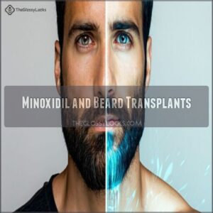 minoxidil and beard transplants