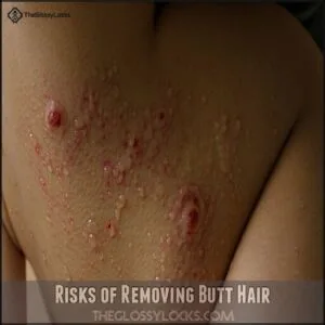 Risks of Removing Butt Hair