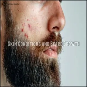 Skin Conditions and Beard Growth Skin Conditions and Beard Growth