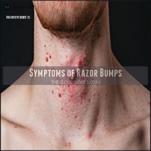 Symptoms of Razor Bumps Symptoms of Razor Bumps