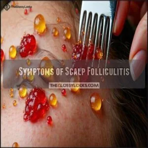 Symptoms of Scalp Folliculitis