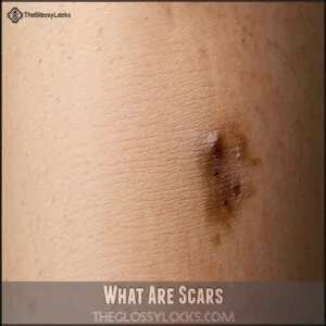 What Are Scars