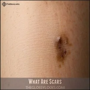 What Are Scars What Are Scars