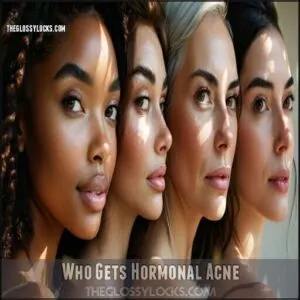Who Gets Hormonal Acne