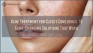acne treatment for closed comedones