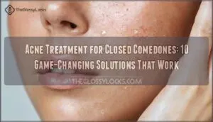 acne treatment for closed comedones