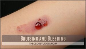 bruising and bleeding