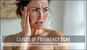 causes of pregnancy acne