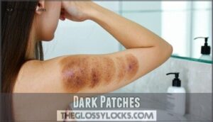 dark patches