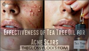effectiveness of tea tree oil for acne scars
