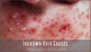 ingrown hair causes