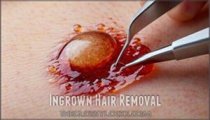 ingrown hair removal