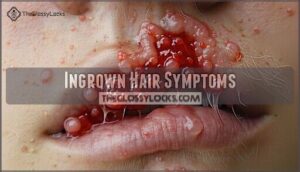ingrown hair symptoms