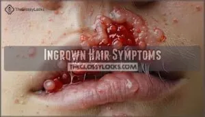 ingrown hair symptoms