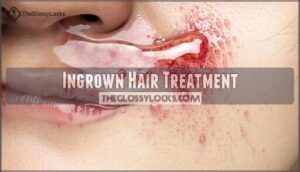 ingrown hair treatment