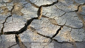 medical conditions