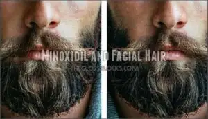 minoxidil and facial hair