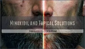 minoxidil and topical solutions minoxidil and topical solutions