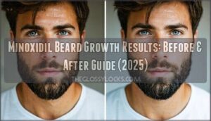 minoxidil beard growth results