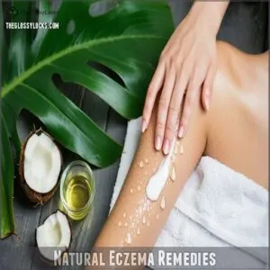 natural eczema remedies