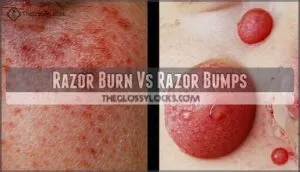 razor burn vs razor bumps