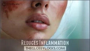 reduces inflammation reduces inflammation