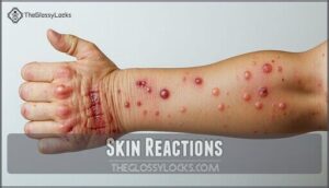skin reactions