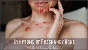 symptoms of pregnancy acne