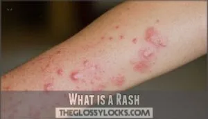 what is a rash