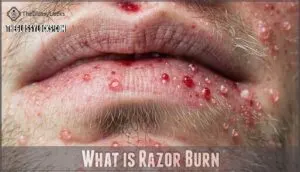 what is razor burn