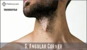 6. angular corner 6. angular corner