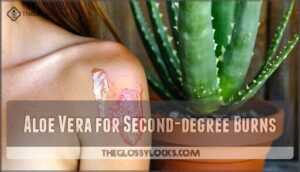 aloe vera for second-degree burns