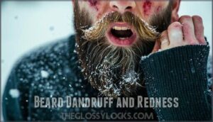 beard dandruff and redness