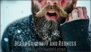 beard dandruff and redness
