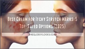 best cream for itchy stretch marks