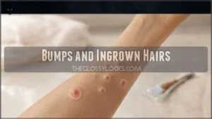 bumps and ingrown hairs