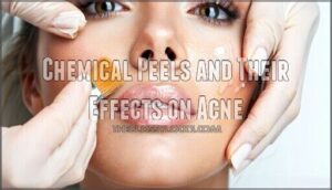 chemical peels and their effects on acne
