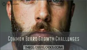 common beard growth challenges