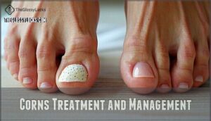 corns treatment and management