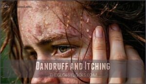 dandruff and itching