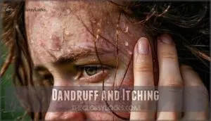 dandruff and itching